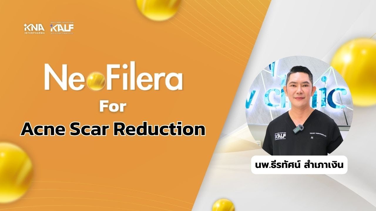 NeoFilera For "Acne Scar Reduction"